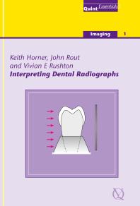Interpreting Dental Radiographs (Quintessentials 5)