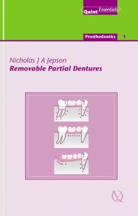 Removable partial dentures (Quintessentials 18) 
