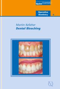 Dental bleaching (Quintessentials 38)