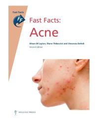 Fast Facts: Acne